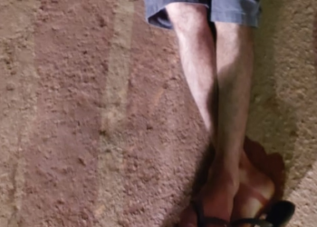 Após levar balaço nos peitos, homem ainda sobrevive