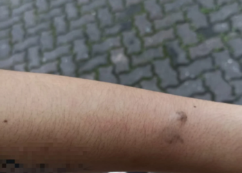 Mãe denuncia agressão de inspetor a estudante do Colégio Pedro II